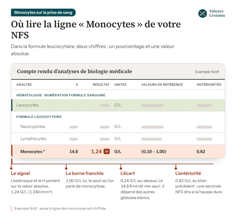 Où lire la ligne « Monocytes » sur un compte rendu de NFS (exemple fictif) Extrait fictif de compte rendu de NFS, formule leucocytaire : la ligne Monocytes à 14,6 % et 1,24 G/L, signalée d’un astérisque et d’un H, pour des valeurs de référence de 0,10 à 1,00 G/L et 0,62 G/L au bilan précédent, sous les lignes leucocytes, neutrophiles et lymphocytes.